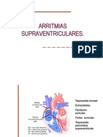 arritmias supraventriculares