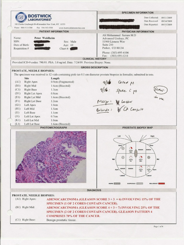 Details Of A Prostate Biopsy