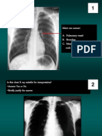 Pretest Chest X-ray Course