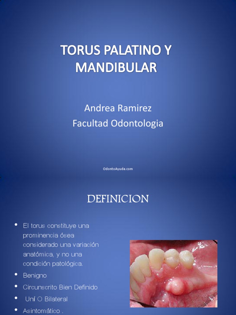 Torus Palatino y Mandibular | PDF | Hueso | Odontología