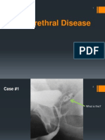 Adult Urethral Disease (Aug 2014)