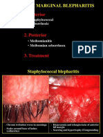 Chronic Marginal Blepharitis