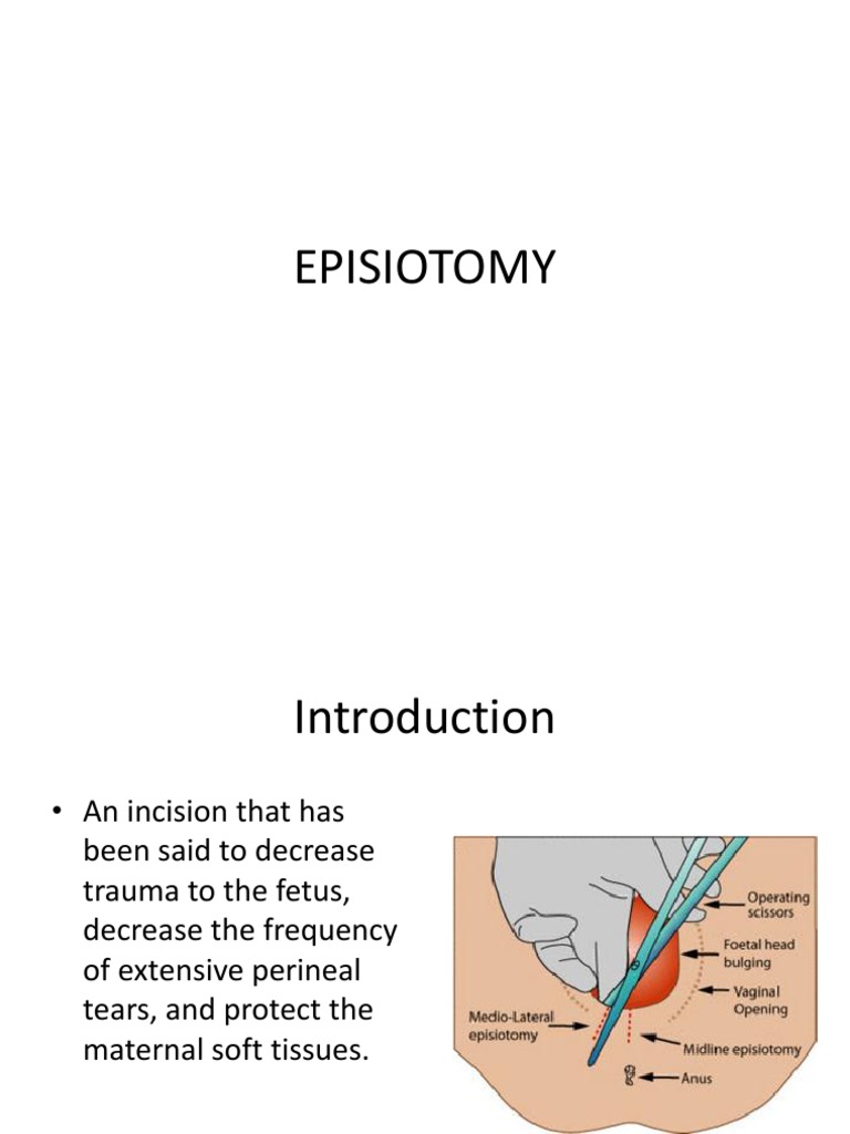 episiotomy case study scribd