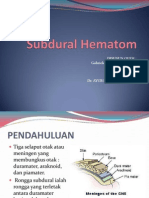 Subdural Hematom