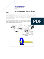 Obtención de Imágenes A Través de Un TC