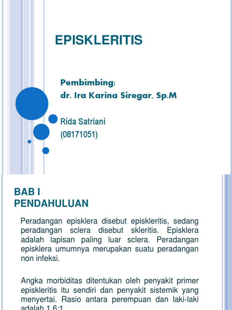 Episkleritis