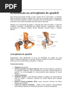 Artroplastia de Quadril