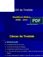 Câncer da Tireóide: Diagnóstico e Tipos Histológicos