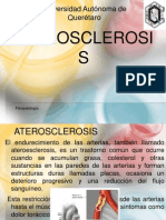 A Tero Sclerosis