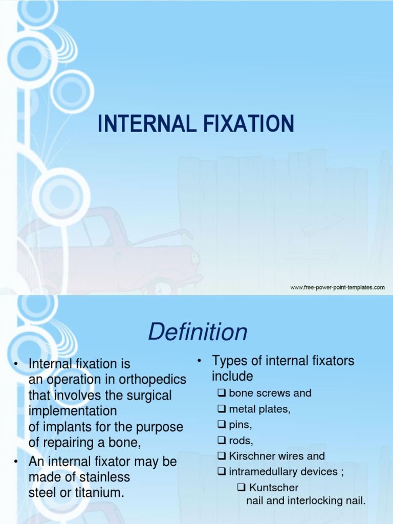 Internal Fixation Device Intramedullary