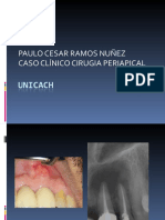 Apical Surgery Clinical Case