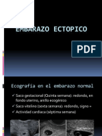 embarazoextopico2012-121020215832-phpapp02