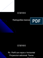 Craneo