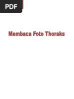 Download Cara Pembacaan Foto Thorax by Sita SN237650831 doc pdf