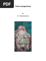 Total Laryngectomy