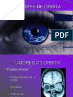 Tumores de Orbita