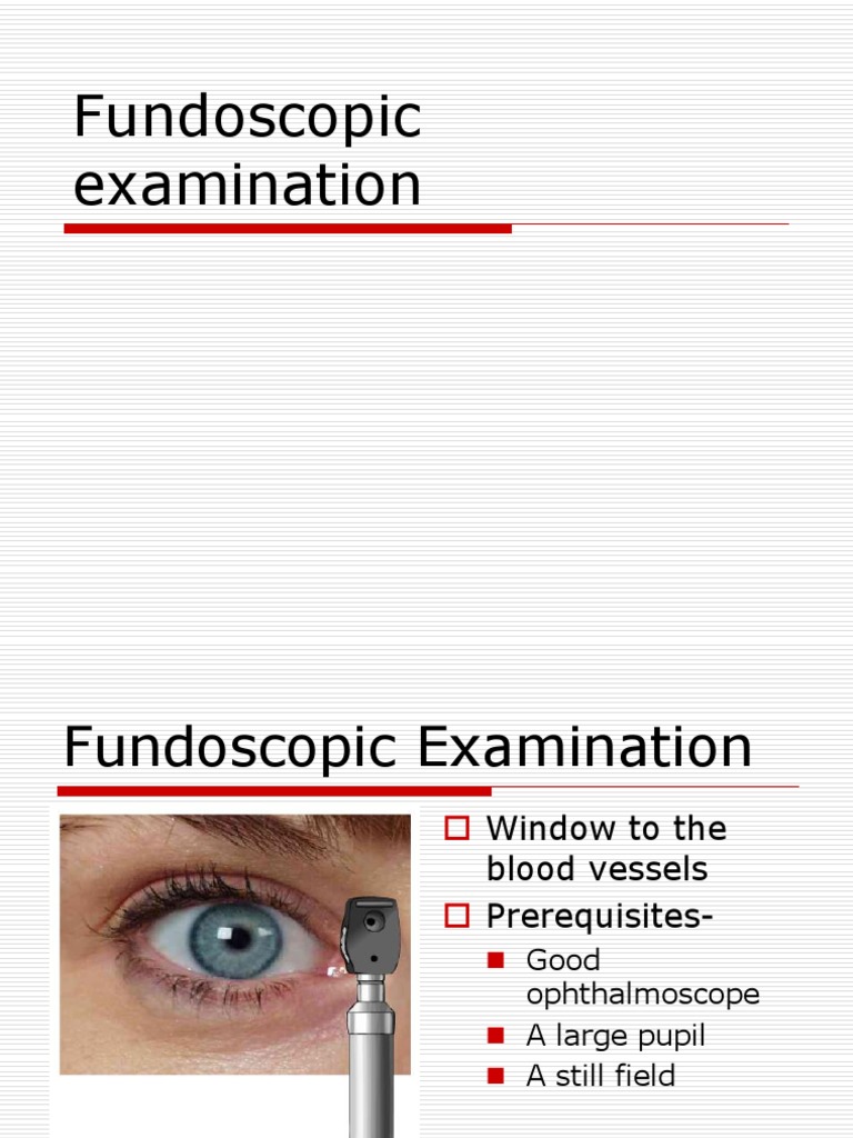 Fundoscopic Examination Techniques Guide | PDF | Retina | Ophthalmology
