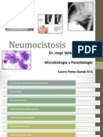 Neumocistosis