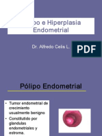 Polipo - Hiperplasia