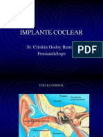 IMPLANTE COCLEAR