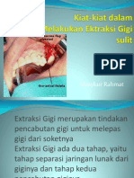 Kiat Kiat Dalam Melakukan Extraksi Gigi Sulit.