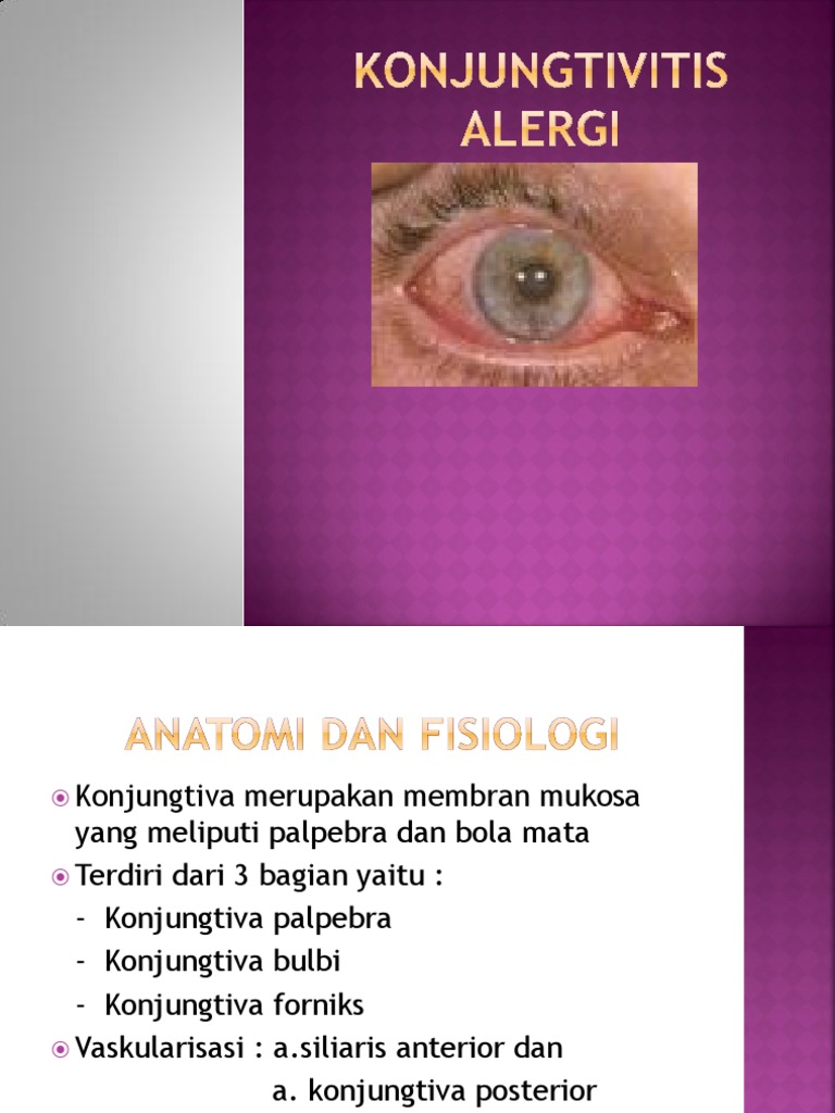 Konjungtivitis Alergi Power Point