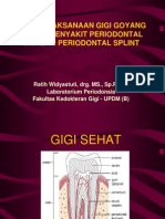 Periodontal Splint 013