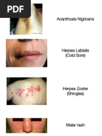 Dermoscopy Patterns and Algorithms | PDF | Melanoma | Skin