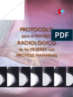 Protocolo radiológico mujeres prótesis mamarias