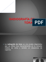 Radiografía de Tórax