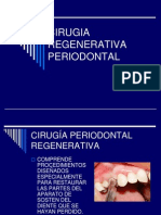 Cirugia Regenerativa Periodontal