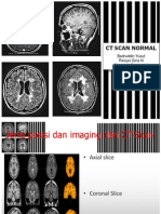 Css - CT Scan Normal