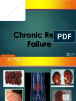 Chronic Renal Failure: Prepared by D. Chaplin