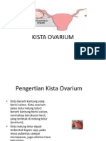 KISTA-OVARIUM.ppt