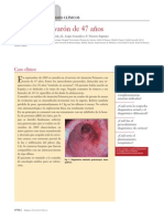 25.10 Pirosis en Un Varón de 47 Años PDF