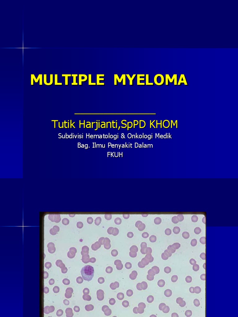 Multiple Myeloma Pdf : Multiple Myeloma: Diagnosis and Treatment – ANHVI