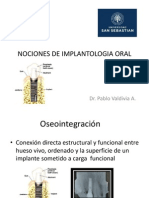 Nociones de Implantologia Oral (2)
