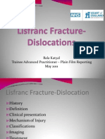 (316235851) Lisfranc Fracture-Dislocations Powerpoint Presentation