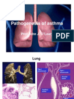 Pathogenesis of Asthma: Prof John J. O'Leary