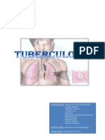 Tuberculosis