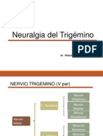 Expo Neuralgia Trigemino