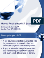 how to read CT scan