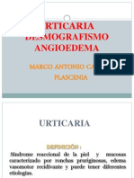 Urticaria