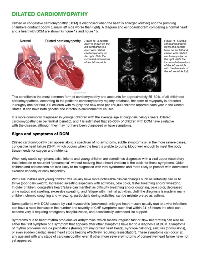 Dilated Cardiomyopathy PDF | PDF | Artificial Cardiac Pacemaker | Heart ...