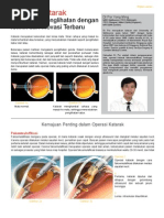 Download prosedur operasi katarak by Okyfredy Anam SN239276021 doc pdf