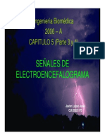 Electro en Cefalo Grama