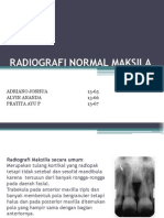 RADIOGRAFI MAKSILA