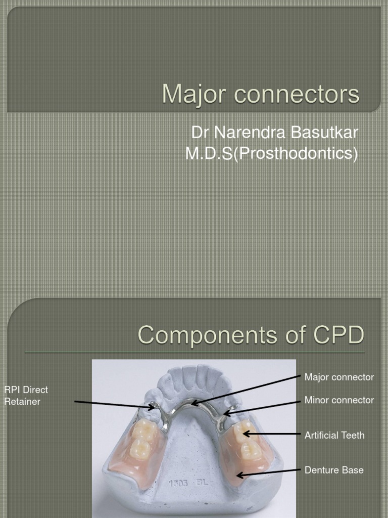 Maxillary Major Connectors in RPDs | PDF | Dentures | Mouth