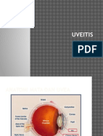 ppt uveitis