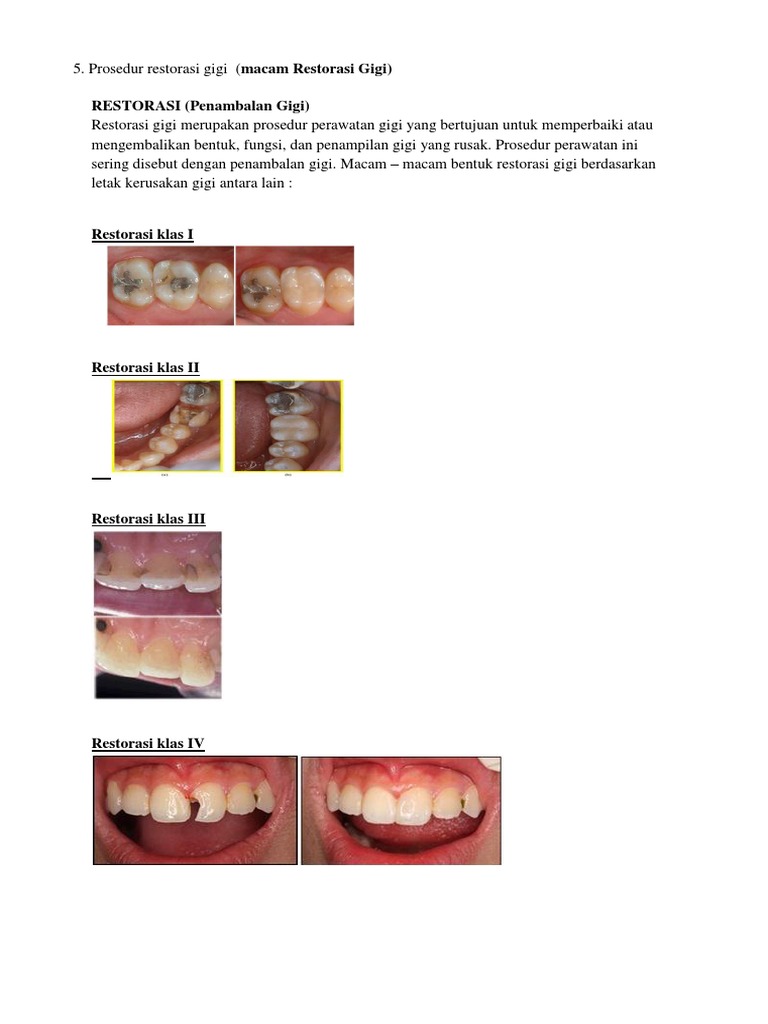 Prosedur dan Jenis Restorasi Gigi | PDF